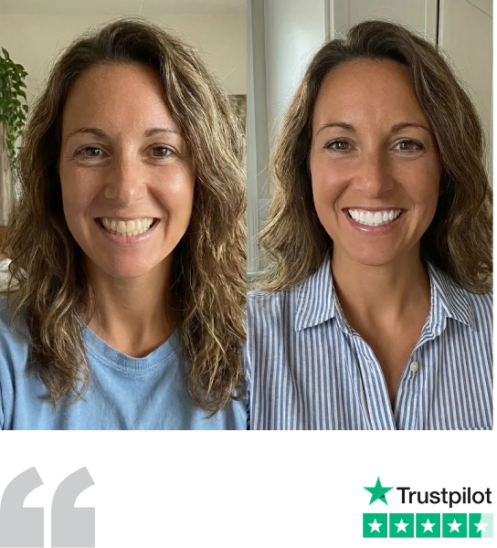 Alexandra's brighter, whiter smile after using SHIMMER, with her 5-star Trustpilot rating