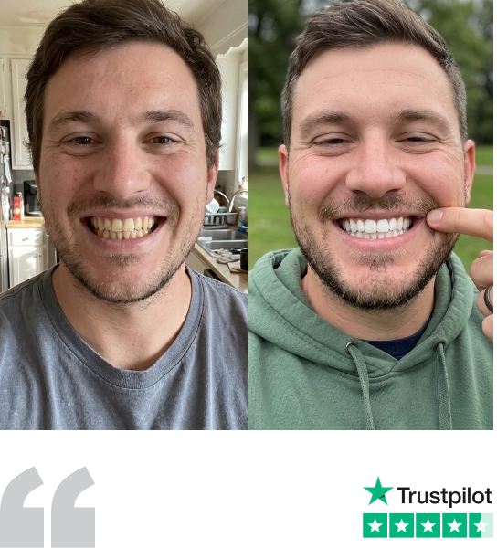 Chris's whiter teeth after using SHIMMER, with his 5-star Trustpilot rating