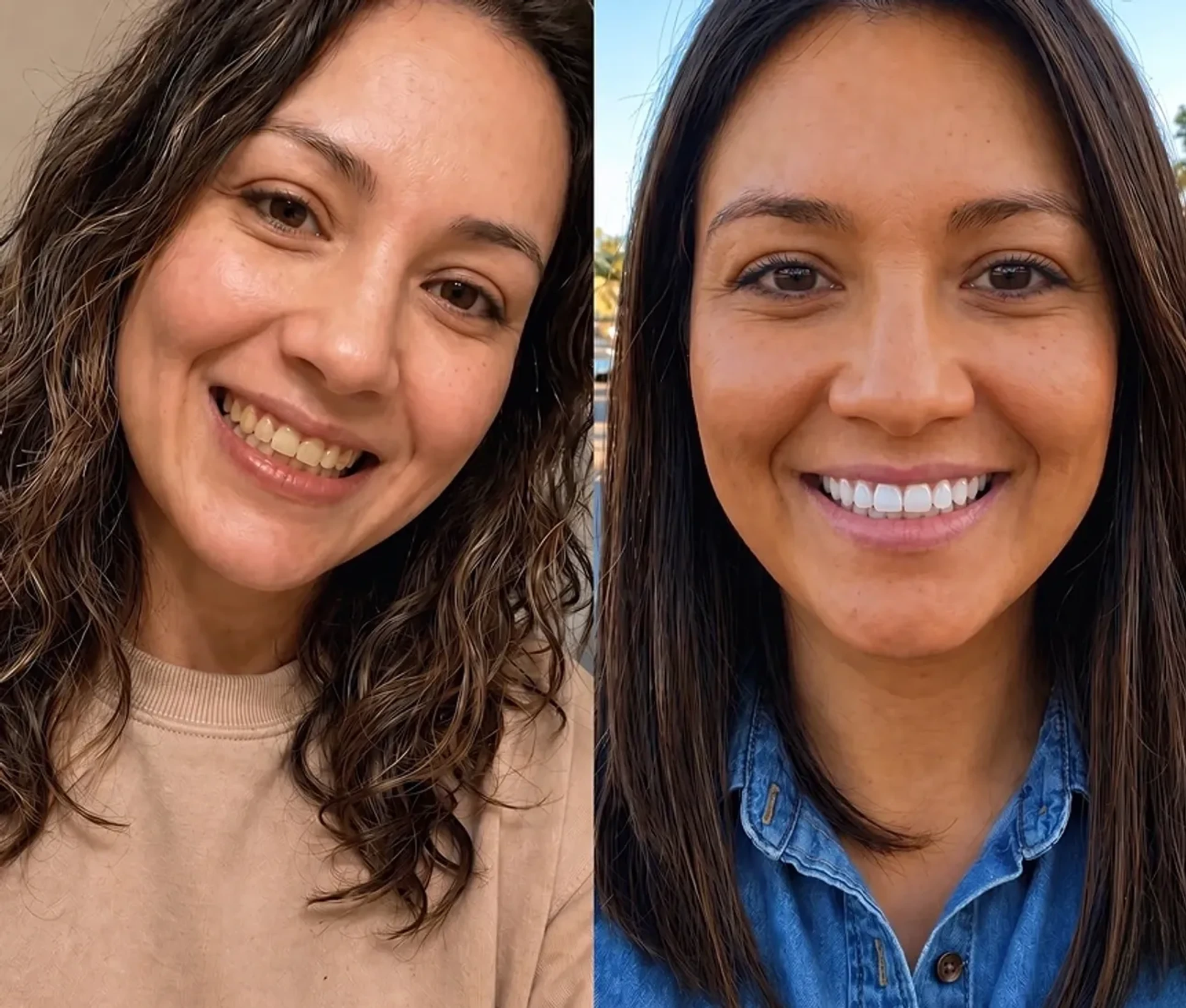 A person showing off a bright, white smile after using SHIMMER whitening tablets